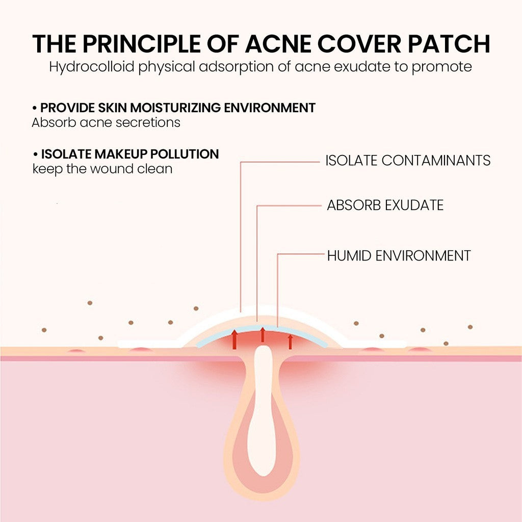 Premium Star Shaped Pimple Patches Pack Of 200