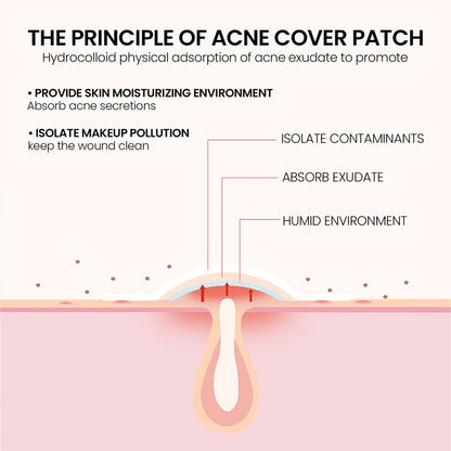 Premium Star Shaped Pimple Patches Pack Of 200