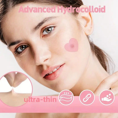 Premium Star Shaped Pimple Patches Pack Of 200