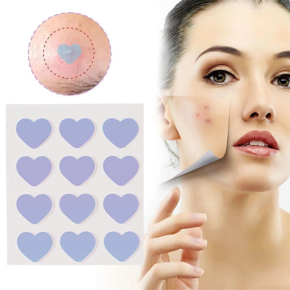 Premium Star Shaped Pimple Patches Pack Of 200